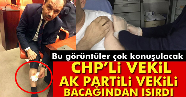 CHP Milletvekili, AK Partili Balta'yı ısırdı