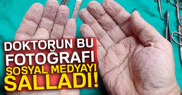 Cerrahın elleri sosyal medyayı salladı