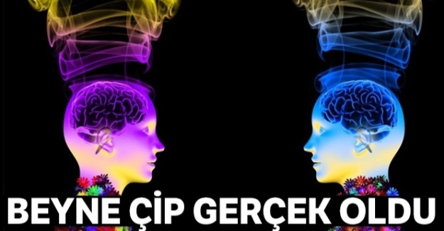 Beyne çip gerçek oldu