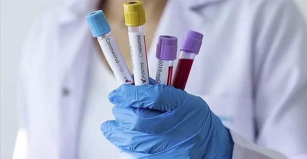 Dünya genelinde koronavirüs nedeniyle hayatını kaybedenlerin sayısı 100 bini aştı