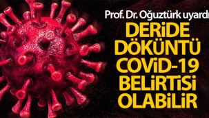 Prof. Dr. Oğuztürk uyardı: 'Deride döküntü Covid-19 belirtisi olabilir'