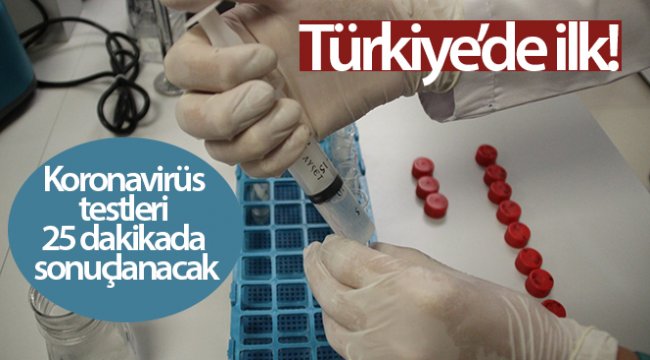 Türkiye'de ilk! Koronavirüs testleri 25 dakikada sonuçlanacak
