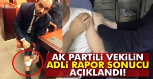 AK Partili Vekilin Adli Rapor Sonucu Açıklandı!