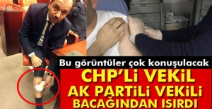 CHP Milletvekili, AK Partili Balta'yı ısırdı